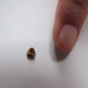 Fotografie mrtvé štěnice v porovnání s nehtem na prstu